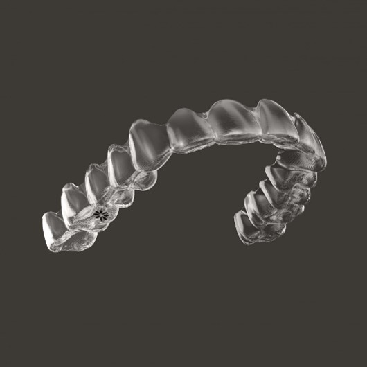 Aligner Orthodontic (Invisalign®)
